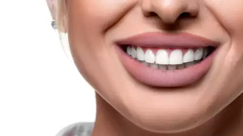 Hollywood Smile: Everything You Need to Know