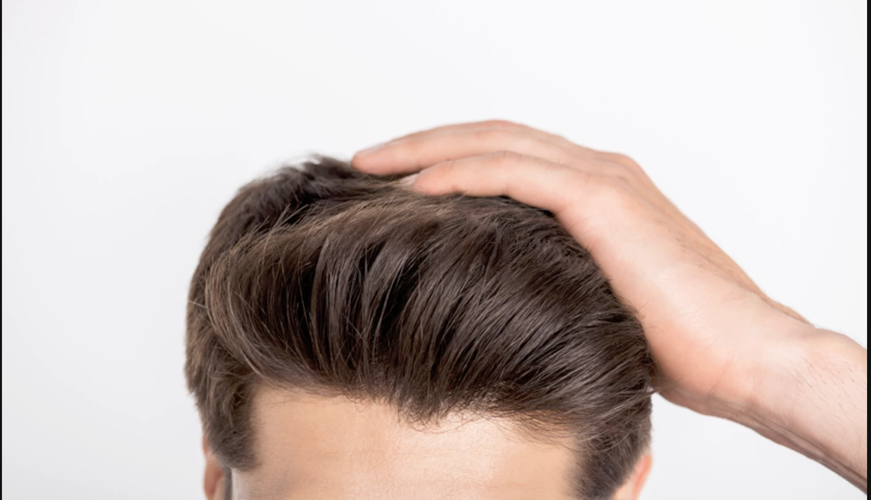 FUE Hair Transplant: The Advanced Solution for Hair Loss