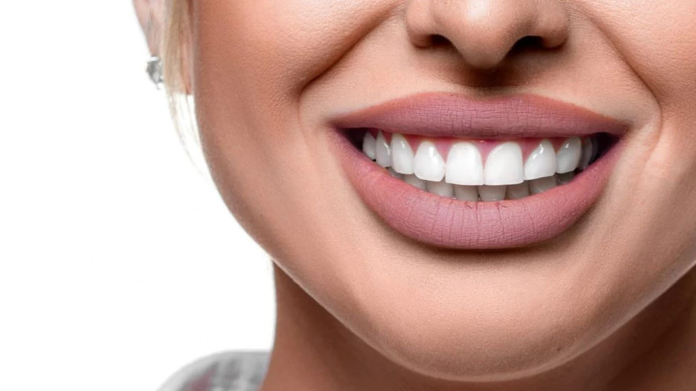 Hollywood Smile: Everything You Need to Know